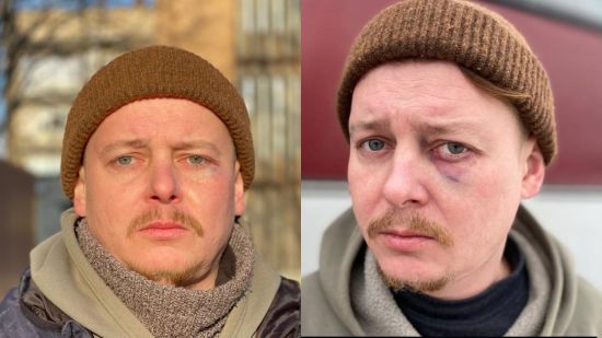 Відомого українського актора побили в Дніпрі